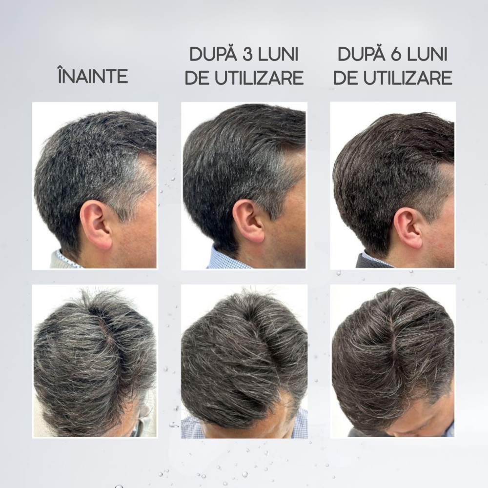 Subrina Professional Anti-greying lotion, 120 ml - Loțiune împotriva încărunțirii, 120 ml - imagine 2
