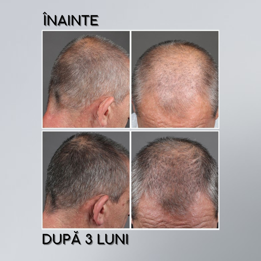 Subrina Professional Anti-greying lotion, 120 ml - Loțiune împotriva încărunțirii, 120 ml - imagine 3
