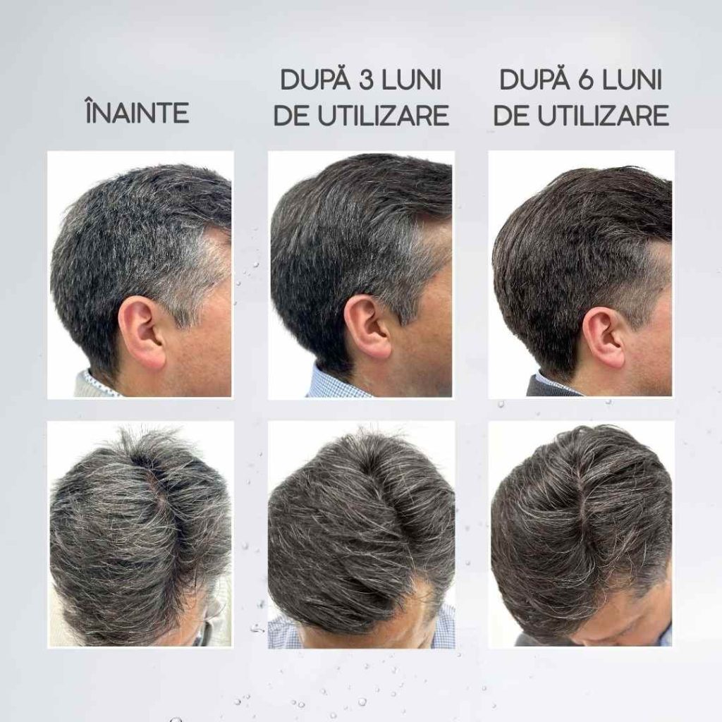 loțiune anti încărunțire